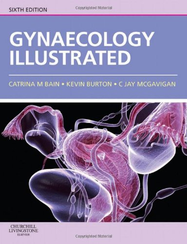 Gynaecology Illustrated 6th Edition Catrina Bain Kevin Burton C Jay Mcgavigan D Mck Hart