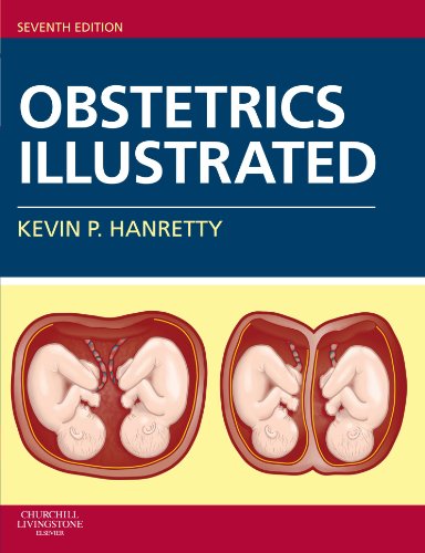 Obstetrics Illustrated 7th Edition Kevin P Hanretty