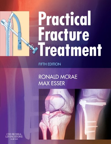 Practical Fracture Treatment 5th Edition Ronald Mcrae Max Esser
