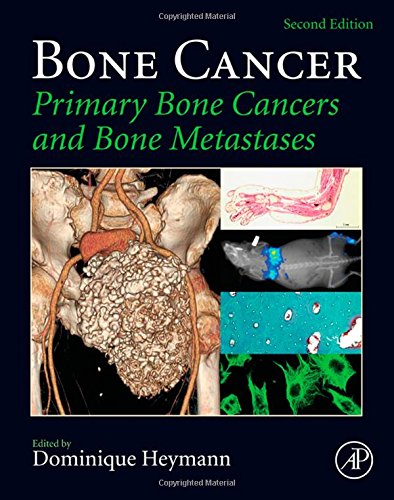 Bone Cancer Primary Bone Cancers And Bone Metastases 2nd Edition Dominique Heymann