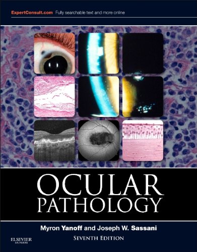 Ocular Pathology 7th Edition Myron Yanoff Joseph W Sassani