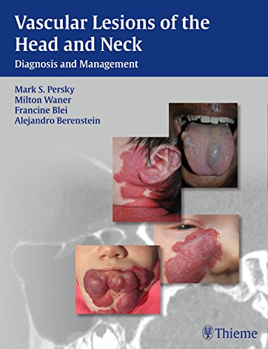 Vascular Lesions Of The Head And Neck Diagnosis And Management 1st Edition Mark S Persky