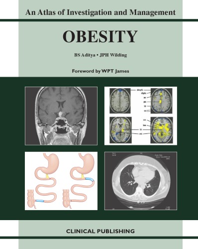 Obesity An Atlas Of Investigation And Management Bs Aditya