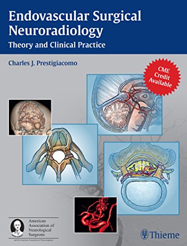 Endovascular Surgical Neuroradiology Theory And Clinical Practice 1st Edition Charles J Prestigiacomo