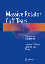 Massive Rotator Cuff Tears Diagnosis And Management 1st Edition Lawrence V Gulotta