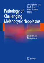 Pathology Of Challenging Melanocytic Neoplasms Diagnosis And Management 1st Edition Christopher R Shea