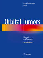 Orbital Tumors Diagnosis And Treatment 2nd Edition Zeynel A Karcioglu Eds
