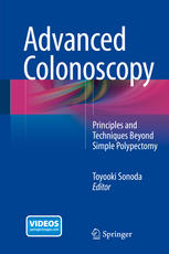 Advanced Colonoscopy Principles And Techniques Beyond Simple Polypectomy 1st Edition Toyooki Sonoda