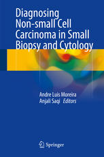 Diagnosing Nonsmall Cell Carcinoma In Small Biopsy And Cytology 1st Edition Andre Luis Moreira