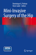 Miniinvasive Surgery Of The Hip 1st Edition Dominique G Poitout