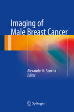 Imaging Of Male Breast Cancer 1st Edition Alexander N Sencha Eds