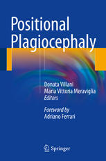 Positional Plagiocephaly 1st Edition Donata Villani Maria Vittoria Meraviglia Eds