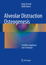 Alveolar Distraction Osteogenesis Archwise Appliance And Technique 1st Edition Nejat Erverdi