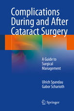 Complications During And After Cataract Surgery A Guide To Surgical Management 1st Edition Ulrich Spandau