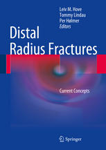 Distal Radius Fractures Current Concepts 1st Edition Leiv M Hove