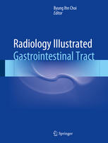 Radiology Illustrated Gastrointestinal Tract 1st Edition Byung Ihn Choi Eds