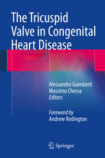 The Tricuspid Valve In Congenital Heart Disease 1st Edition Alessandro Giamberti