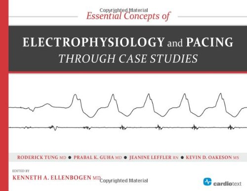 Essential Concepts Of Electrophysiology And Pacing Through Case Studies 1st Edition Kenneth A Ellenbogen