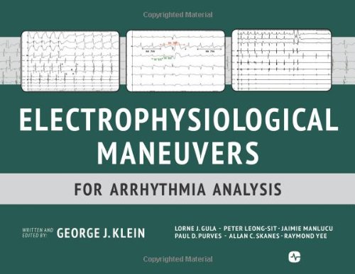 Electrophysiological Maneuvers For Arrhythmia Analysis 1st Edition George J Klein