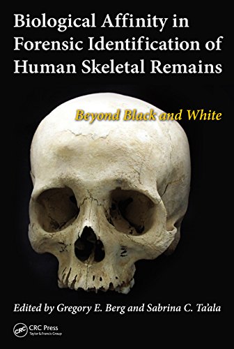 Biological Affinity In Forensic Identification Of Human Skeletal Remains Beyond Black And White Gregory E Berg