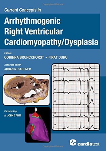Current Concepts In Arrhythmogenic Right Ventricular Cardiomyopathy Dysplasia 1st Edition Corinna Brunckhorst