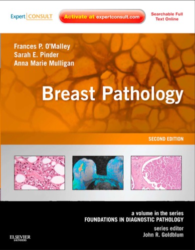Breast Pathology A Volume In The Series Foundations In Diagnostic Pathology 2nd Edition Frances P Malley