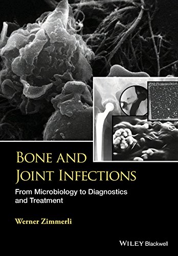 Bone And Joint Infections From Microbiology To Diagnostics And Treatment 1st Edition W Zimmerli