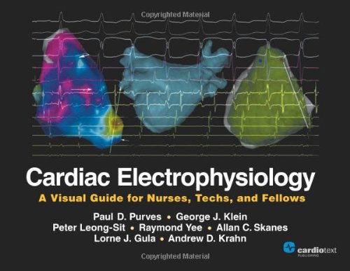 Cardiac Electrophysiology A Visual Guide For Nurses Techs And Fellows 1st Edition Paul D Purves