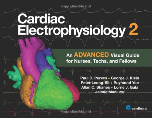 Cardiac Electrophysiology 2 An Advanced Visual Guide For Nurses Techs And Fellows 1st Edition Paul D Purves