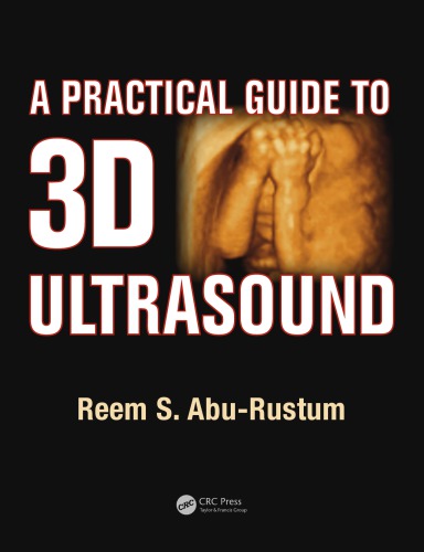 A Practical Guide To 3d Ultrasound Reem S Aburustum
