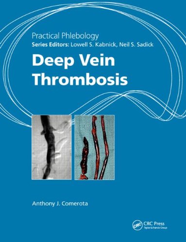 Practical Phlebology Deep Vein Thrombosis 1st Edition Anthony J Comerota