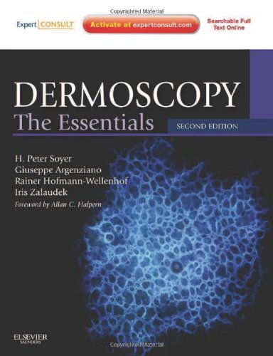 Dermoscopy The Essentials Expert Consult Online And Print 2e 2nd Edition H Peter Soyer Md Facd