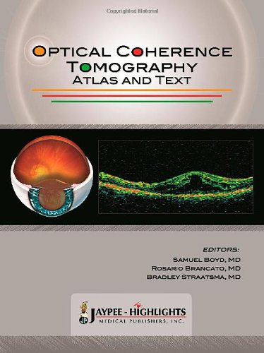 Optical Coherence Tomography Atlas And Text Boyd Samuel Brancato Rosario
