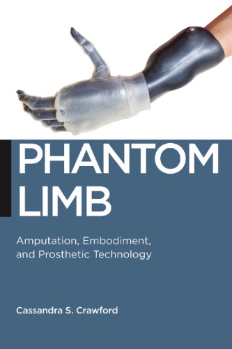 Phantom Limb Amputation Embodiment And Prosthetic Technology Cassandra S Crawford