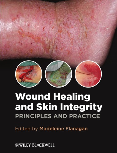 Wound Healing And Skin Integrity Madeleine Flanagan