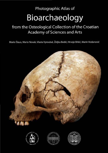 Photographic Atlas Of Bioarchaeology From The Osteological Collections Of The Croatian Academy Of Sciences And Arts Mario Slaus