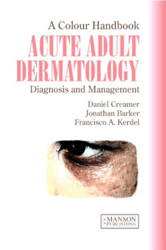 Acute Adult Dermatology Diagnosis And Management A Colour Handbook Daniel Creamer