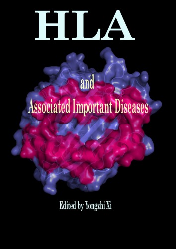 Hla And Associated Important Diseases Yongzhi Xi
