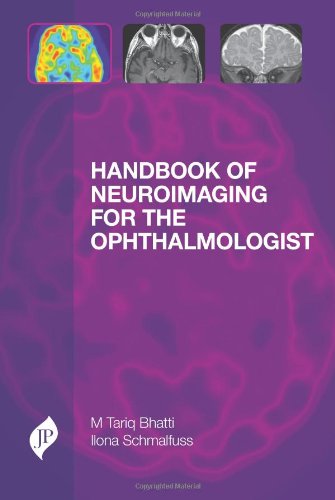 Handbook Of Neuroimaging For The Ophthalmologist M Tariq Bhatti