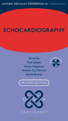 Echocardiography 2nd Edition Paul Leeson Andrew Rj Mitchell