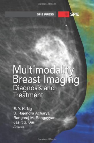 Multimodality Breast Imaging Diagnosis And Treatment 1st Edition E Y K Ng