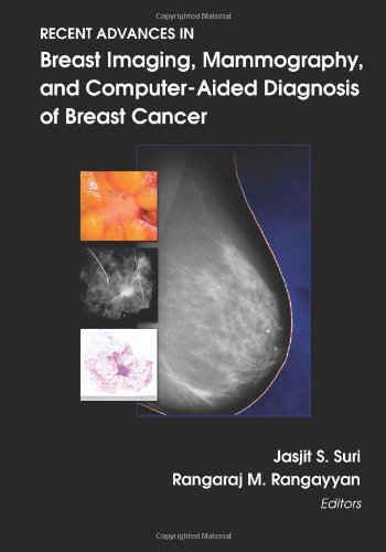 Recent Advances In Breast Imaging Mammography And Computeraided Diagnosis Of Breast Cancer Jasjit S Suri