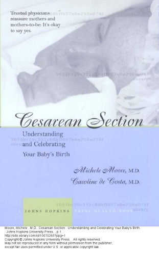 Cesarean Section Understanding And Celebrating Your Babys Birth Michelle Moore And Caroline De Costa