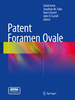 Patent Foramen Ovale 1st Edition Zahid Amin Jonathan M Tobis