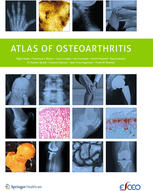 Atlas Of Osteoarthritis 1st Edition Nigel Arden Francisco Blanco