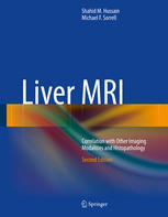Liver Mri 2nd Edition Shahid M Hussain Md Michael F Sorrell Md Auth