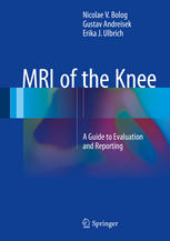 Mri Of The Knee A Guide To Evaluation And Reporting 1st Edition Nicolae V Bolog