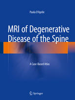 Mri Of Degenerative Disease Of The Spine A Casebased Atlas 1st Edition Paola Daprile Auth