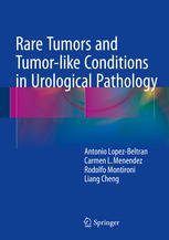 Rare Tumors And Tumorlike Conditions In Urological Pathology 1st Edition Antonio Lopezbeltran