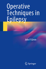 Operative Techniques In Epilepsy 1st Edition John P Girvin Auth